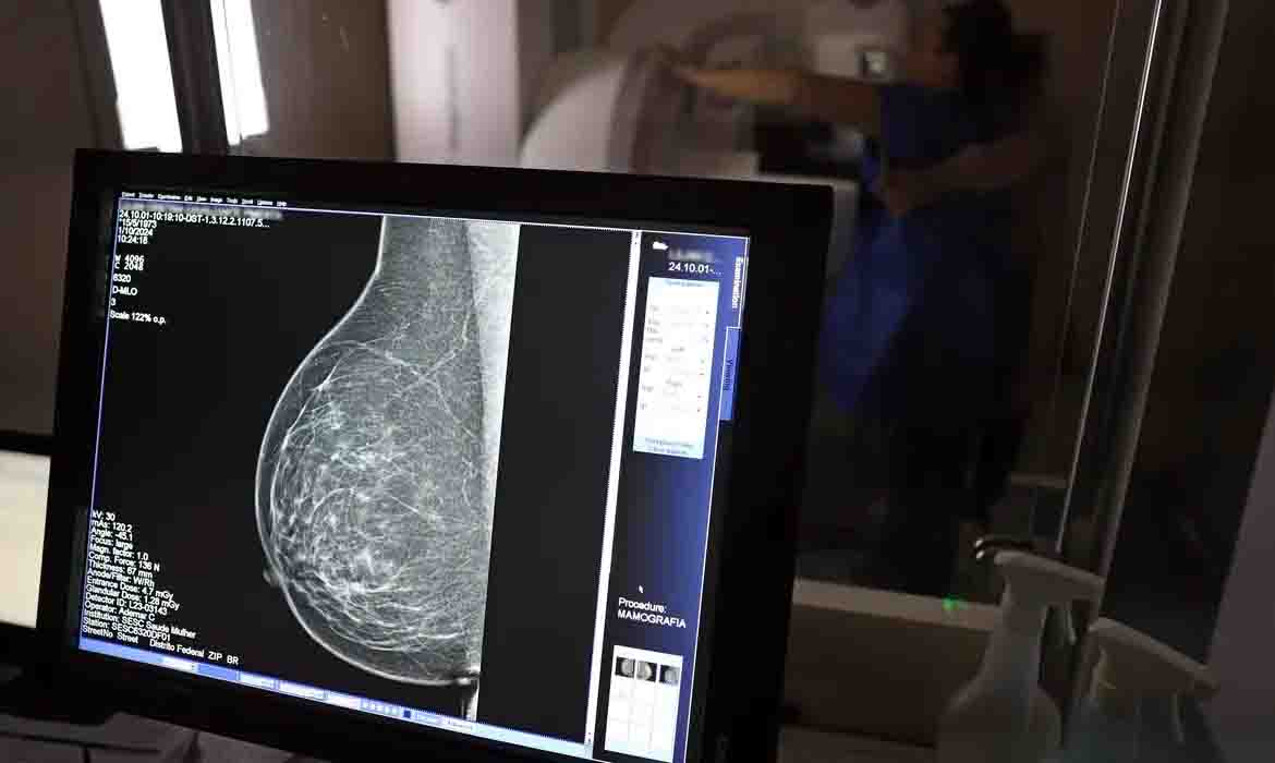 Entidades médicas pedem faixa etária maior para mamografia de rastreio