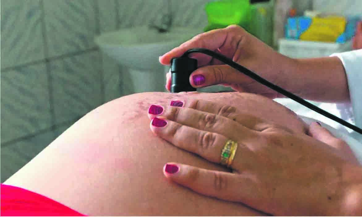 Pré-natal Odontológico: Um cuidado que protege a mamãe e o bebê